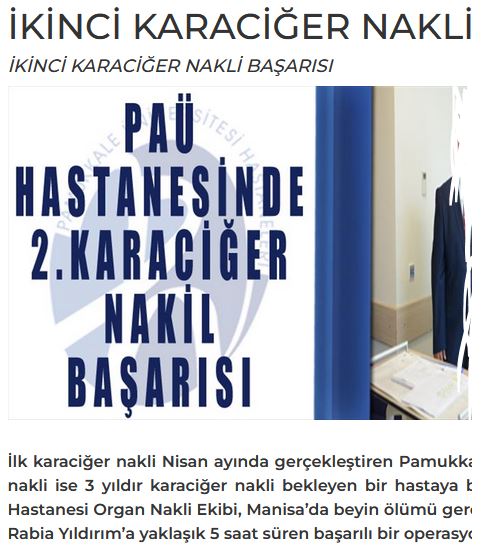 karaciğer nakli